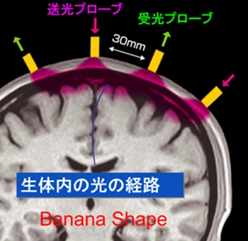 図１の画像
